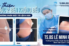 Cải thiện ngực hai bên không đều