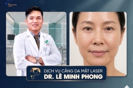 Căng Da Mặt Laser