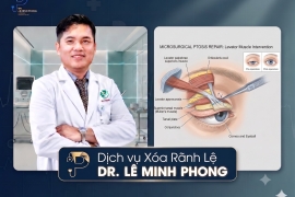Xóa Rãnh Lệ