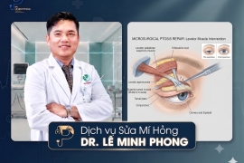 Sửa Mí Hỏng