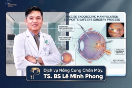 Nâng Cung Chân Mày