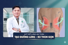 Hút Mỡ Lưng