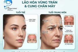 Căng Da Trán