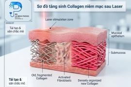 Trẻ Hóa Vùng Kín Laser