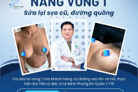 Nâng ngực sa trễ & thu nhỏ sẹo cũ đường quầng 
