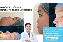 Mũi cấu trúc sụn SURGIFORM 