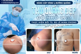 Thu Nhỏ Quầng Vú