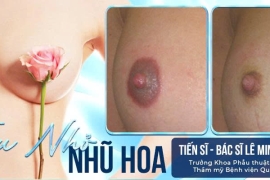 Làm Hồng Nhũ Hoa