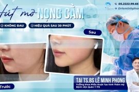 Hút Mỡ Nọng Cằm