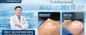 Đường Nâng Bên Hông Sườn Và Đường Quầng: Đâu Là Lựa Chọn Tối Ưu?