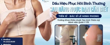 Dấu Hiệu Phục Hồi Bình Thường Sau Nâng Ngực Bạn Cần Biết