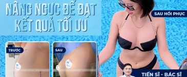 Bí Quyết Chăm Sóc Sau Phẫu Thuật Thẩm Mỹ Nâng Ngực Để Đạt Kết Quả Tối Ưu
