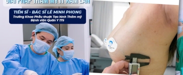 Nâng Ngực Đường 2cm Bên Hông Sườn Ngực: Giải Pháp Ít Xâm Lấn