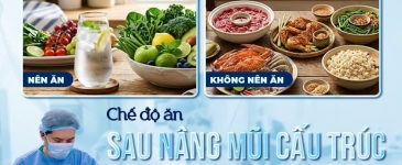 Chế độ ăn sau nâng mũi cấu trúc