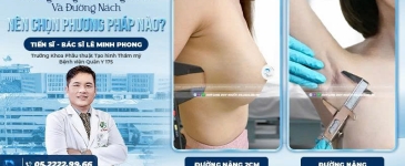 Đường Nâng Bên Hông Sườn Và Đường Nách: Nên Chọn Phương Pháp Nào?