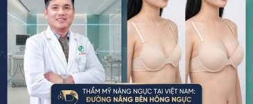 Thẩm mỹ nâng ngực tại Việt Nam: từ kỹ thuật truyền thống đến đường nâng bên hông ngực