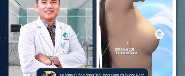 So Sánh Đường Nâng Bên Hông Sườn Và Đường Nách: Đâu Là Lựa Chọn Tối Ưu?