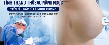 THÔNG KHE – NHỮNG YẾU TỐ CÓ THỂ DẪN ĐẾN TÌNH TRẠNG THÔNG KHE SAU NÂNG NGỰC