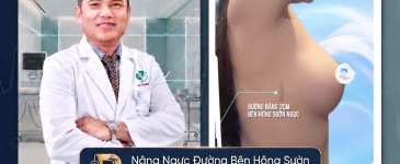 Nâng Ngực Đường Bên Hông Sườn Bao Lâu Hồi Phục?