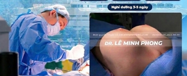 Sau Nâng Ngực Bao Lâu Được Mặc Áo Ngực?