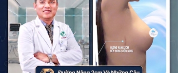 Đường Nâng 2cm Và Những Câu Hỏi Thường Gặp Từ Khách Hàng