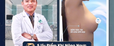 5 Ưu Điểm Khi Nâng Ngực Qua Đường Bên Hông Sườn