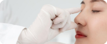 Thẩm mỹ nâng mũi