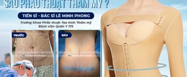 Mặc Áo Định Hình Sau Hút Mỡ Bao Lâu Là Hợp Lý?