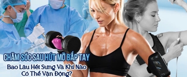 Sau Hút Mỡ Bắp Tay Bao Lâu Có Thể Sinh Hoạt Bình Thường?