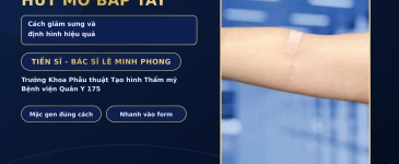 Chăm Sóc Sau Hút Mỡ Bắp Tay: Cách Giảm Sưng Và Định Hình Hiệu Quả