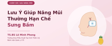Lưu ý giúp nâng mũi thường hạn chế sưng bầm