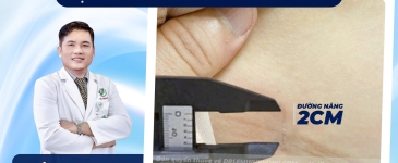 Đường Nâng 2cm Có Thật Sự Ít Đau Hơn Các Đường Mổ Truyền Thống?