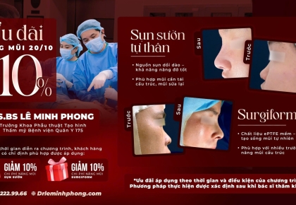 Ưu đãi nâng mũi 20/10 – Giảm 10% nâng mũi sụn sườn và Surgiform cùng TS. BS Lê Minh Phong