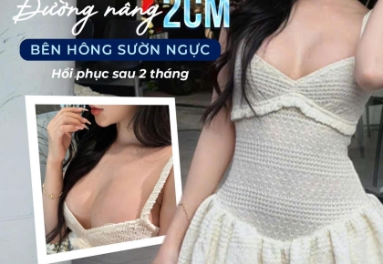 Đường nâng ngực bên hông sườn là gì? Xu hướng nâng ngực mới tại bệnh viện chính thống