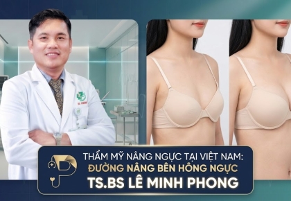 Thẩm mỹ nâng ngực tại Việt Nam: từ kỹ thuật truyền thống đến đường nâng bên hông ngực