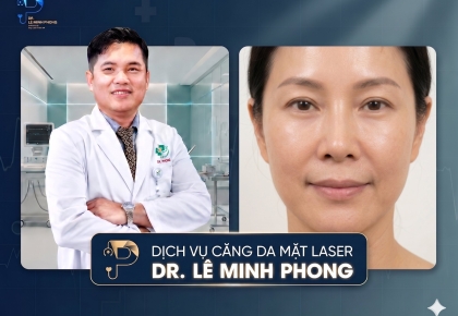 Căng Da Mặt Laser