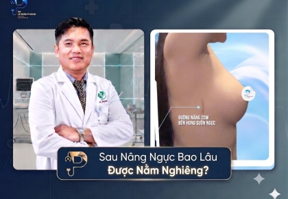 Sau Nâng Ngực Bao Lâu Được Nằm Nghiêng?