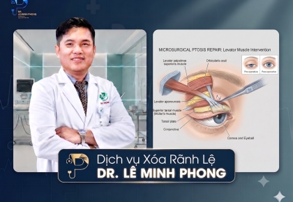 Xóa Rãnh Lệ