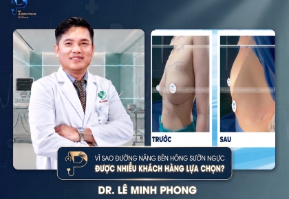 Vì Sao Đường Nâng Bên Hông Sườn Ngực Được Nhiều Khách Hàng Lựa Chọn?