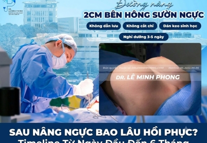 Sau Nâng Ngực Bao Lâu Hồi Phục? Timeline Từ Ngày Đầu Đến 6 Tháng