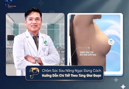 Chăm Sóc Sau Nâng Ngực Đúng Cách: Hướng Dẫn Chi Tiết Theo Từng Giai Đoạn