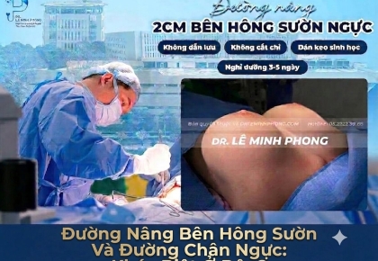 Đường Nâng Bên Hông Sườn Và Đường Chân Ngực: Khác Biệt Ở Đâu?
