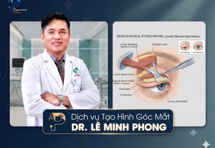 Tạo Hình Góc Mắt