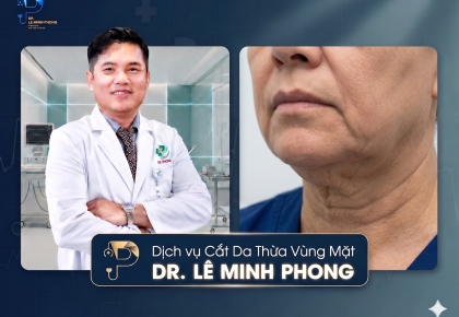Cắt Da Thừa Vùng Mặt