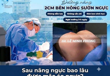 Sau Nâng Ngực Bao Lâu Được Mặc Áo Ngực?