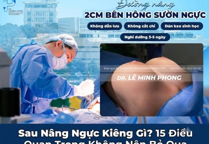 Sau Nâng Ngực Kiêng Gì? 15 Điều Quan Trọng Không Nên Bỏ Qua