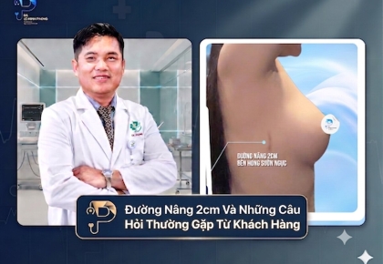 Đường Nâng 2cm Và Những Câu Hỏi Thường Gặp Từ Khách Hàng