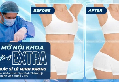 Giảm Mỡ Nội Khoa Lipo Extra