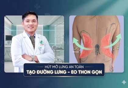 Hút Mỡ Lưng