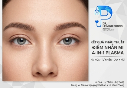 Cắt Mí 4 In 1 Plasma